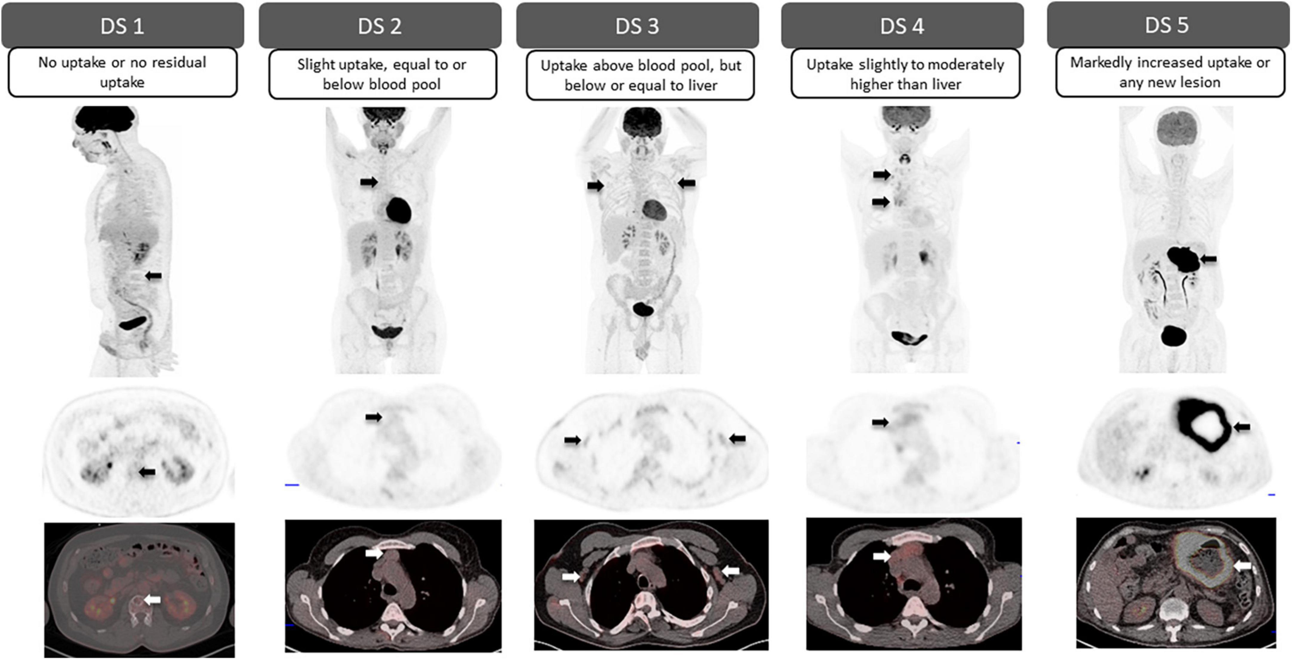 Standardized classification schemes in reporting oncologic PET/CT
